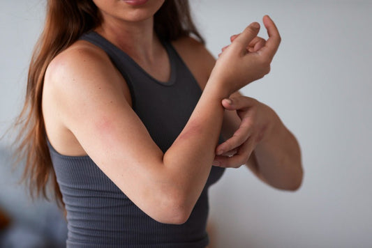 Démystification des Causes de l'Eczéma : Comprendre les Origines de cette Affection Cutanée - lofficinedumonde.fr