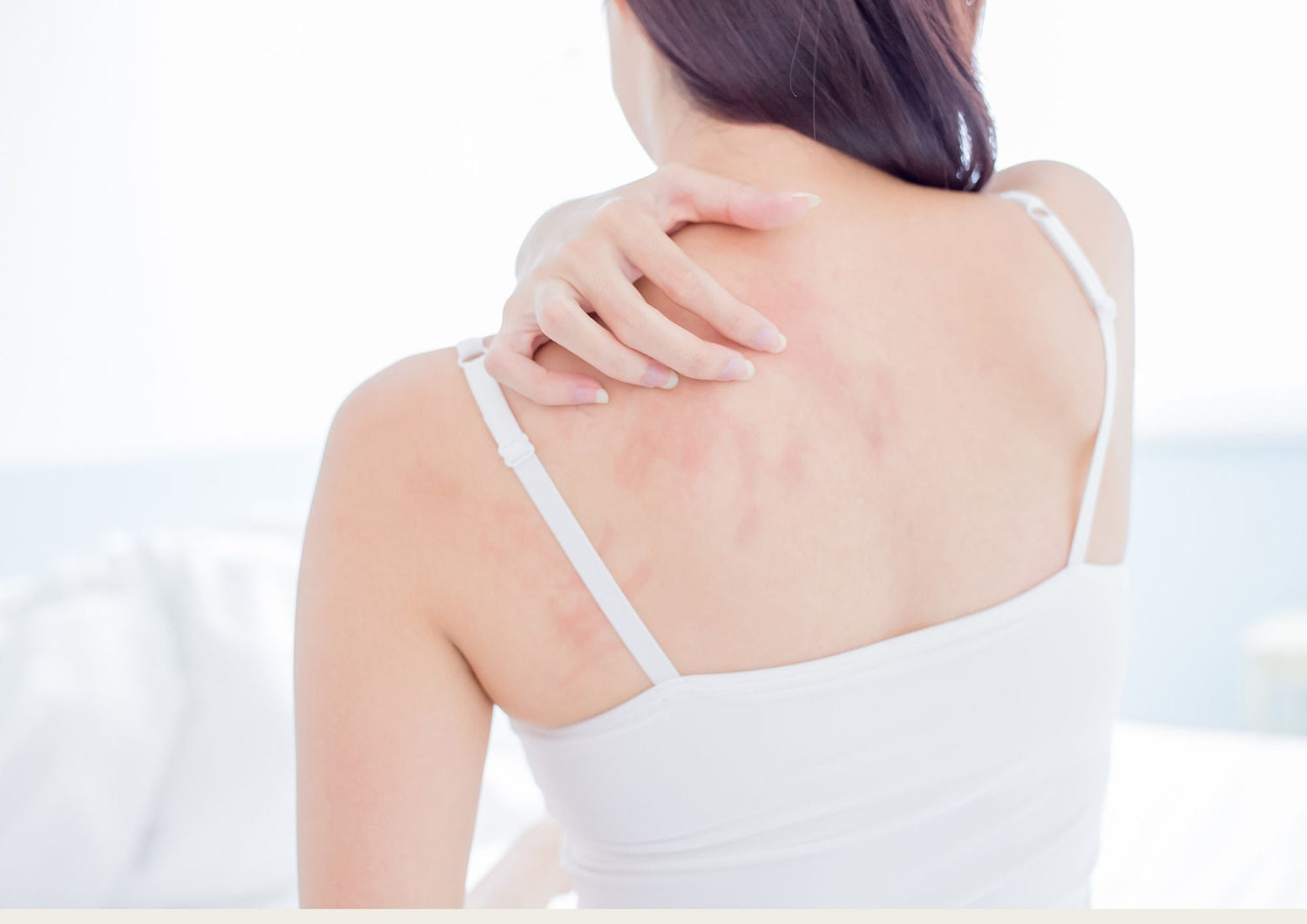 Eczéma : Causes et alternatives naturelles à son traitement - lofficinedumonde.fr